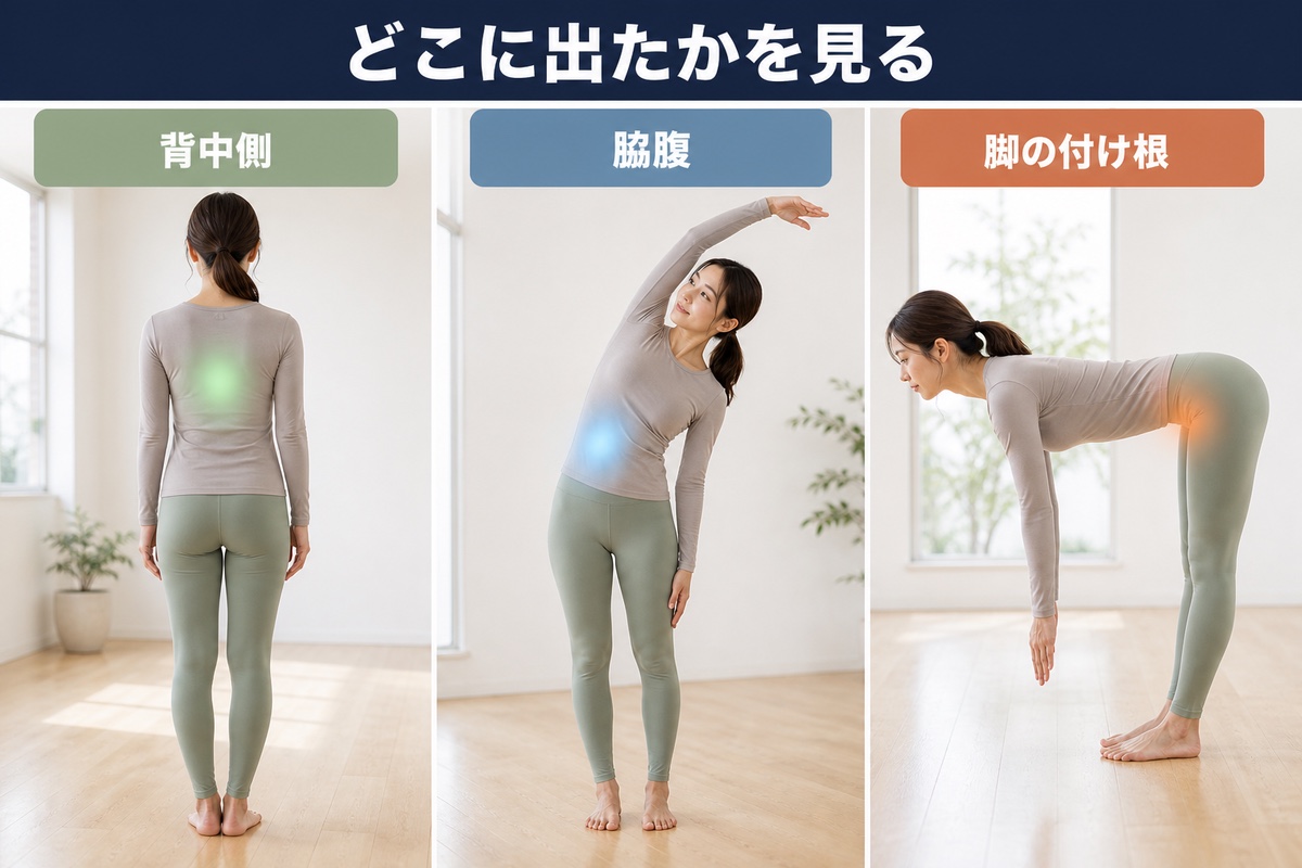 筋肉痛が出る場所で分かること。背中側、脇腹、脚の付け根