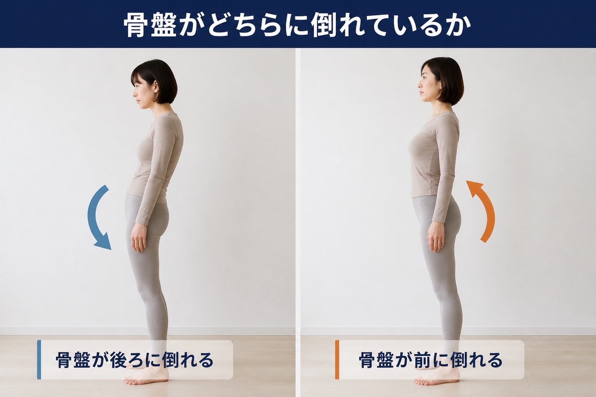 猫背と反り腰の違い。骨盤が後ろに倒れる向きと、前に倒れる向き